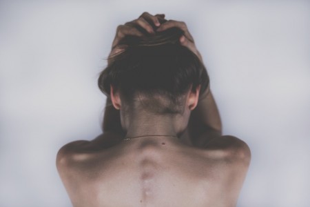 perte de cheveux chez la femme
